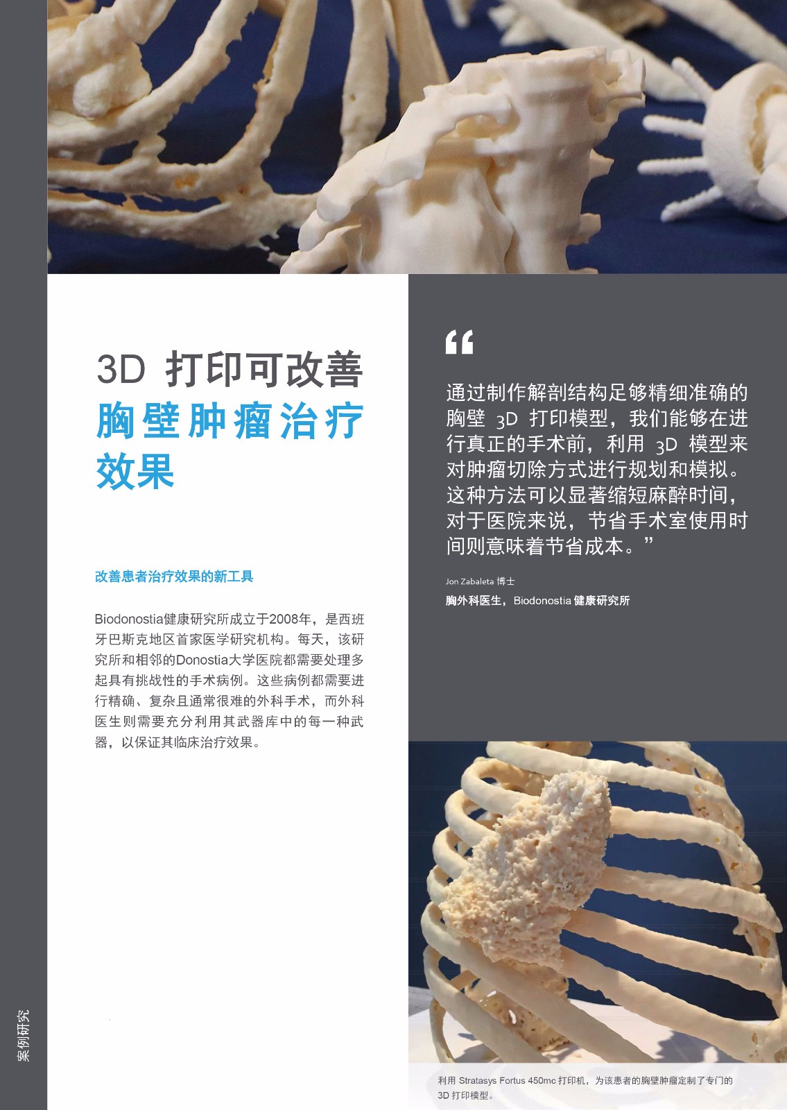 3D打印可改善胸壁肿瘤治疗效果